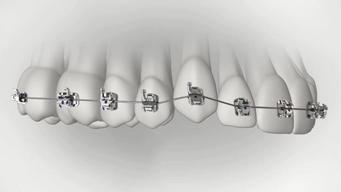 承德市哪家口腔醫(yī)院口腔正畸做得好？惟德口腔醫(yī)院來告訴您