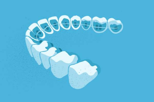 惟德口腔醫(yī)院口腔正畸好不好？